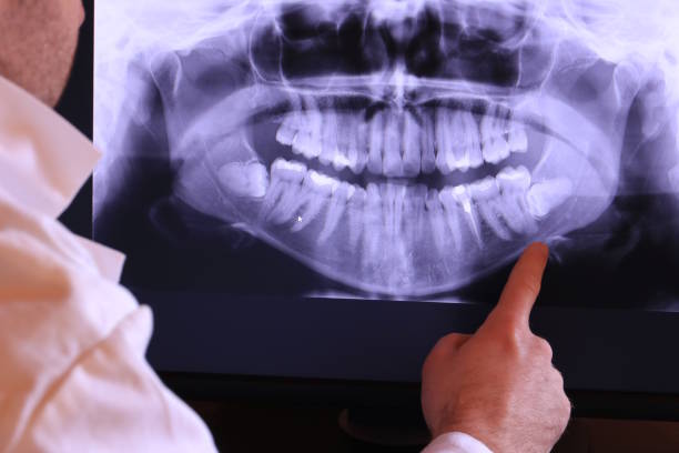 Best Chipped Tooth Repair Near Me  in Odessa, TX