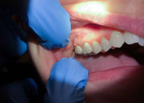 Best Emergency Gum Pain Relief  in Odessa, TX