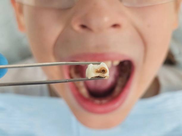 Best Knocked-Out Tooth Emergency  in Odessa, TX